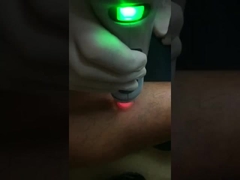 Gentlemax Pro 755nm Alexandrite Laser+1064nm ND YAG Laser Hair Removal